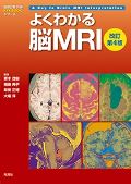 よくわかる脳MRI　改訂第4版